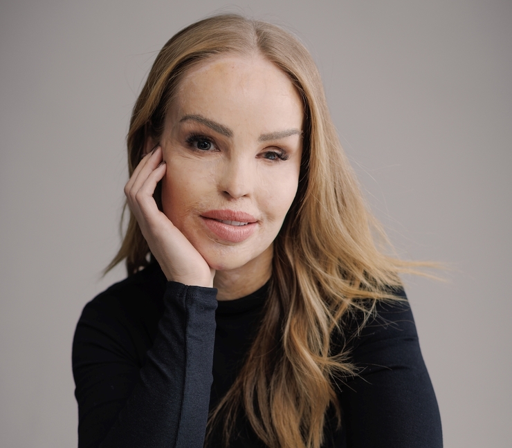 Featured image of JFOW 25: Katie Piper Obe